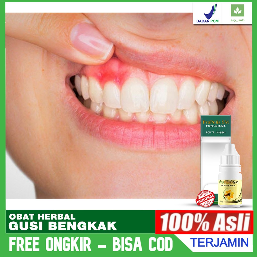 Osagi Obat Sakit Gigi Plus Propolis Sunherbal