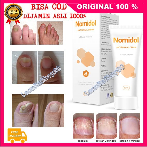 [BISA COD] Nomidol Obat Jamur Kuku ORIGINAL