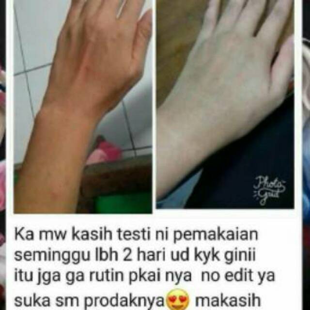 Bibit pemutih badan super dosis tinggi ampuh murah/bibit pemutih badan super kinclong dan tercepat