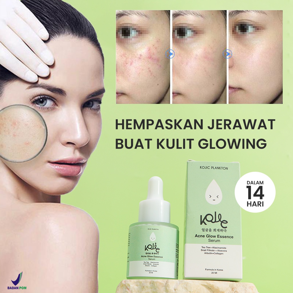 Kojic Acne Glow Essence Serum