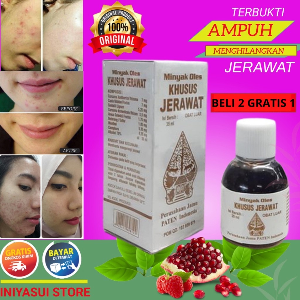 COD Obat Totol Jerawat Obat Jerawat Dan Bekas Jerawat Paling Ampuh Penghilang Jerawat Dan Bekas Jera