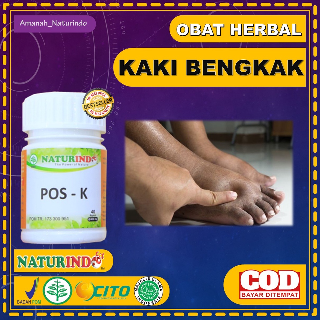 Jual Obat Kaki Bengkak Karena Jatuh Kaki Gajah Kaki Bengkak Keseleo POS