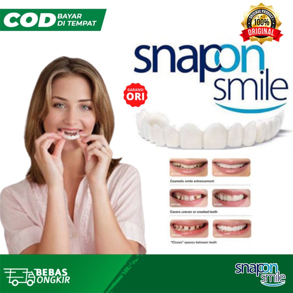 Gigi Palsu Instan Snap On Smile Garansi Original Authentic Veneer gigi Snapon Smile Bawah dan Atas