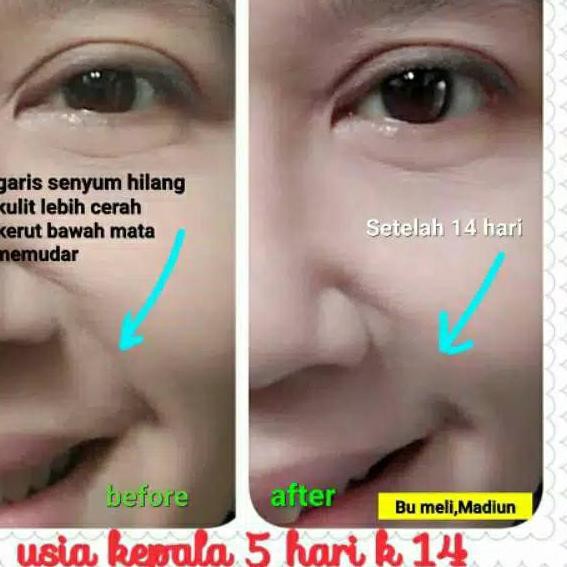 NEW PRODUK כ 25 ml BOTOL ASLI Black jam original raw klink/ krim ala Korea TUR09 . . ..