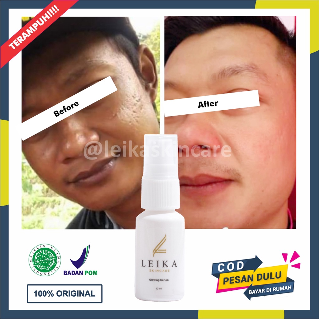 Serum Pemutih Wajah Glowing BPOM Serum Pemutih Wajah Cepat Halal Serum Untuk Pemutih Wajah Pria Ampu