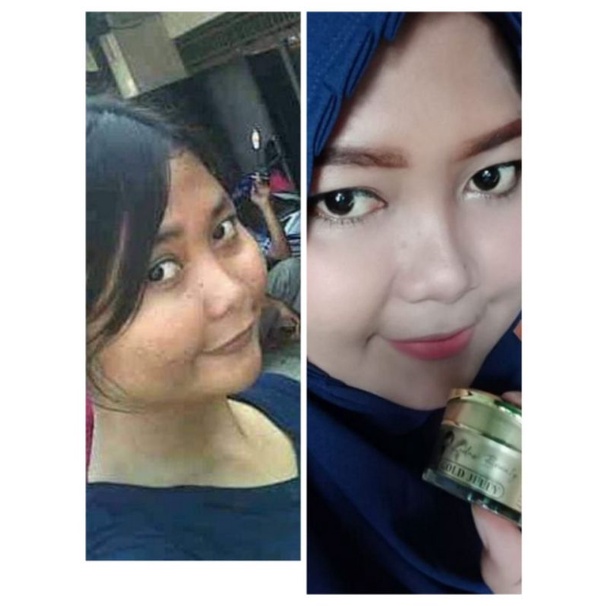 GOLD JELLY KEDAS BEAUTY BPOM GLOWING SEHAT