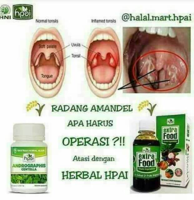 Andrographis Centella Hni Hpai Obat Antibiotik Alami Influenza Batuk Shopee Indonesia