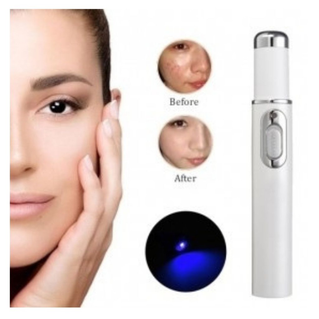 Laser Pen Alat Penghilang Jerawat Blue Light Ray Acne Treatment 111