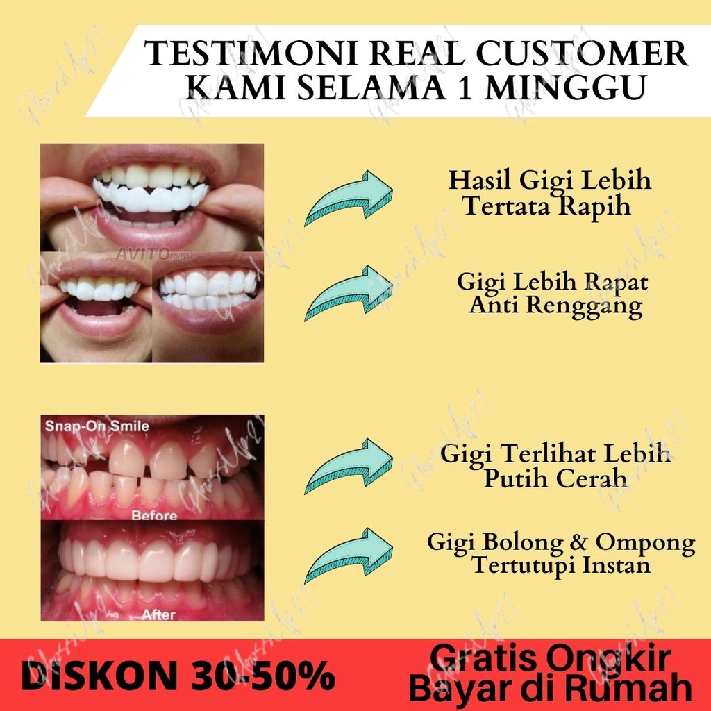 Snap On Smile 100% ORIGINAL Authentic Perawatan Kesehatan Gigi Palsu Renggang Snapon Smile 1 Set