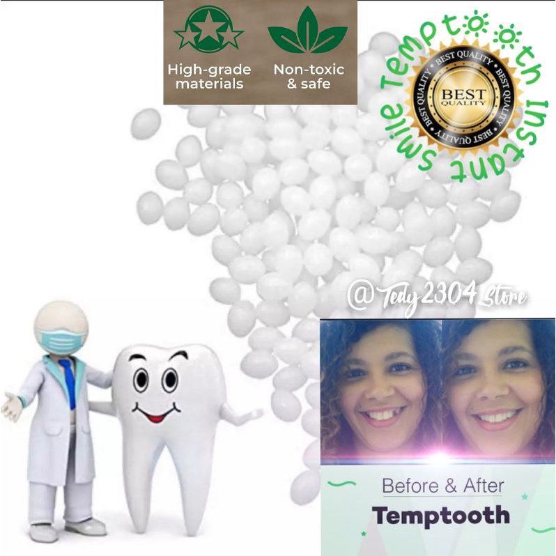 Temptooth/gigi tiruan/gigi palsu/gigi veneer buat sendiri