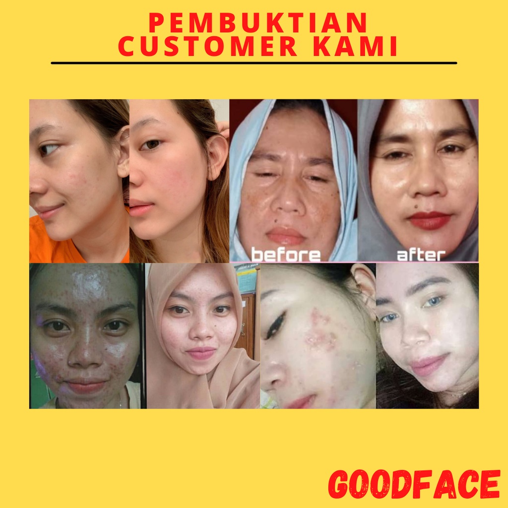 SERUM PEMUTIH PECERAH WAJAH WHITELAB INTENSE BRIGHTENING SERUM - NIACINAMIDE 10% PERAWATAN WAJAH
