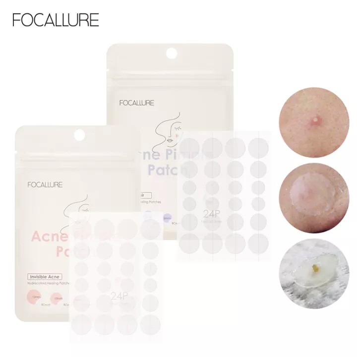 Focallure Acne Patch Focallure Pimple Patch Focallure Acne Pimple Patch Focallure Penutup Jerawat Stiker Jerawat Plaster Jerawat  Plester Jerawat  Masker Jerawat Patch Jerawat Focallur Fucallure Focalure Focallur