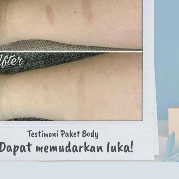 ➧ BLEME BODY LOTION / BLEME BODY LOTION ORI / BLEME HAND BODY LOTION / BLEME SERUM WAJAH / BLEME UND