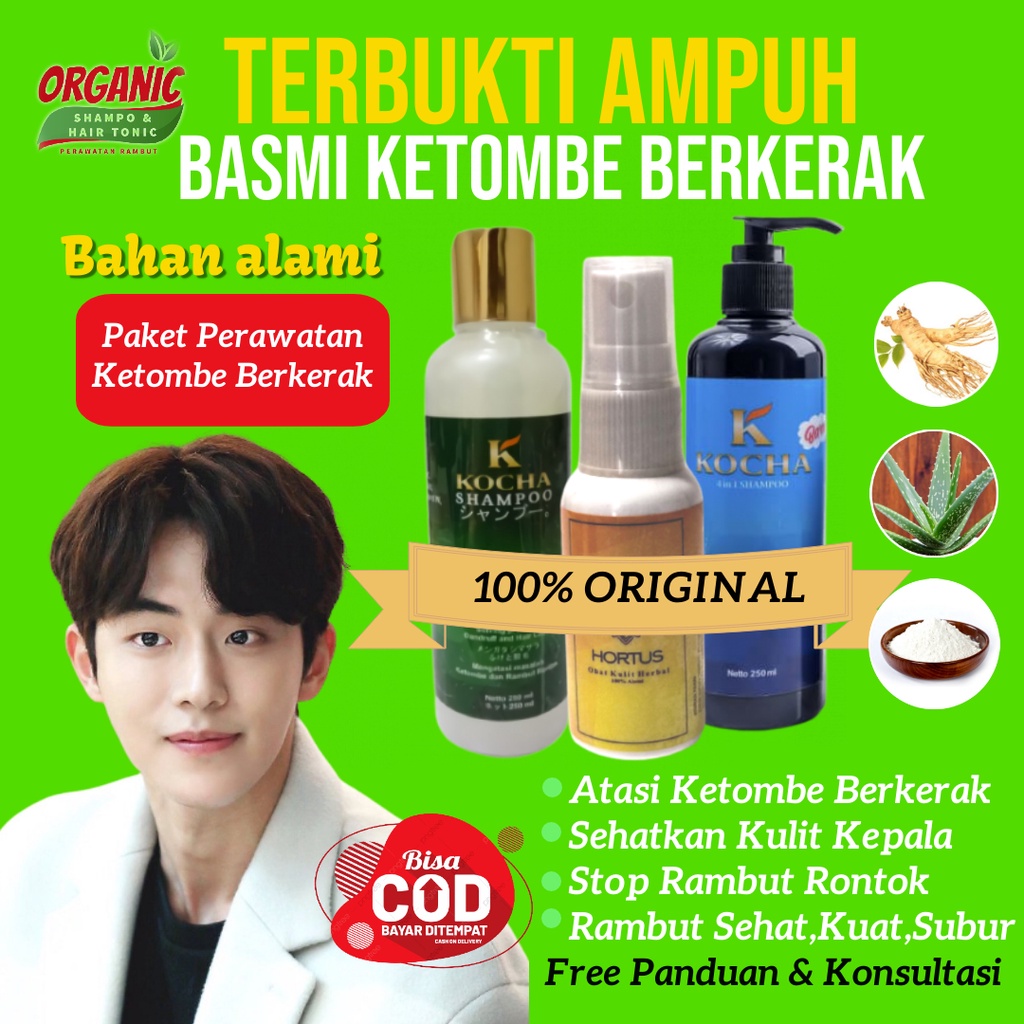 Obat Hortus  Penghilang Ketombe Rambut Berkerak Basah dan Paket Perawatan Kulit Kepala Treatment Sha
