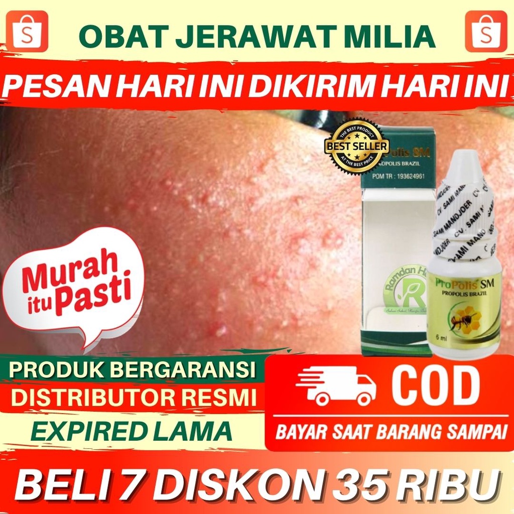 Propolis, Obat JERAWAT MILIA, Penghilang JERAWAT MILIA Di Area Mata, JERAWAT MILIA Di Wajah, Propoli