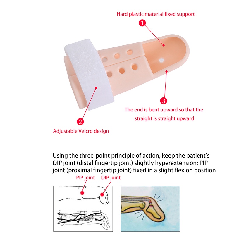 Pelindung Penyangga Jari Tangan/Finger Fixing Splint/Pelindung Jari Cedera/Pelurus Jari