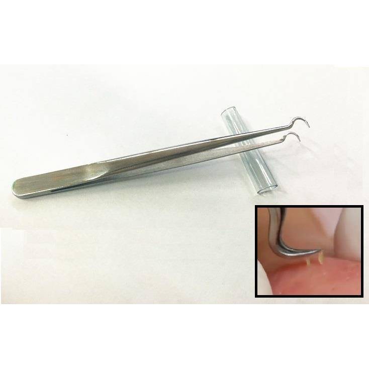 pinset komedo - alat pembersih komedo - blackhead remover