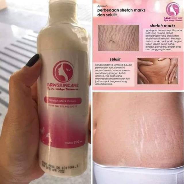 Cream Stretch Mark Krim Selulit Drw Skincare Shopee Indonesia