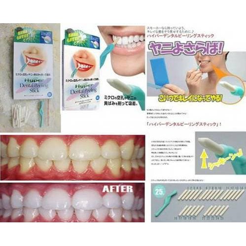 HYPER DENTAL PEELING STICK Kesehatan gigi dan pemutih gigi