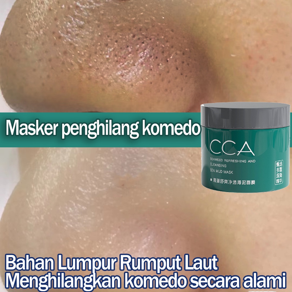 Masker pemutih wajah Masker Perawatan Jerawat Dalam Masker pelembab Masker jerawat dan bekas jerawat 150g Bahan lumpur alga Cleanser acne facial cleanser Kontrol Minyak Menyegarkan Tidak Sesak Deep Cleansing Penghapusan Komedo Penghapusan Jerawat