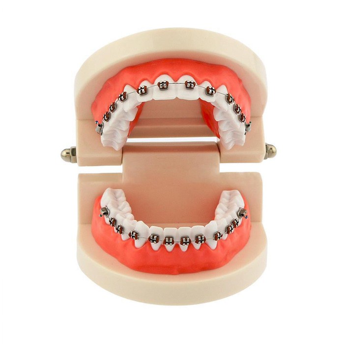 Dental model ortho study model orthodontic phantom studi behel braces bracket kawat gigi metal