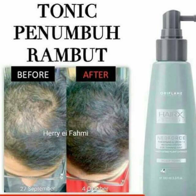 HairX Advance Neoforce/ Penumbuh Rambut Oriflame