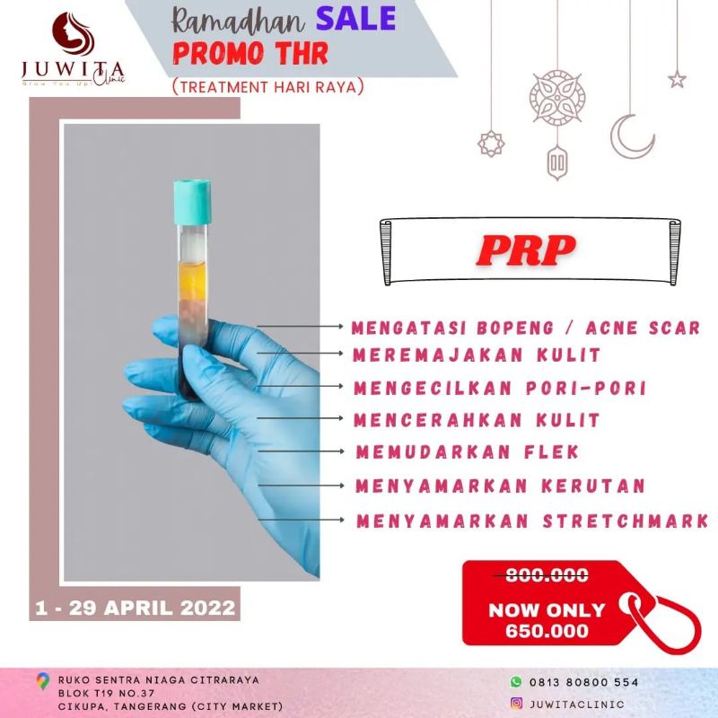 PRP Treatment