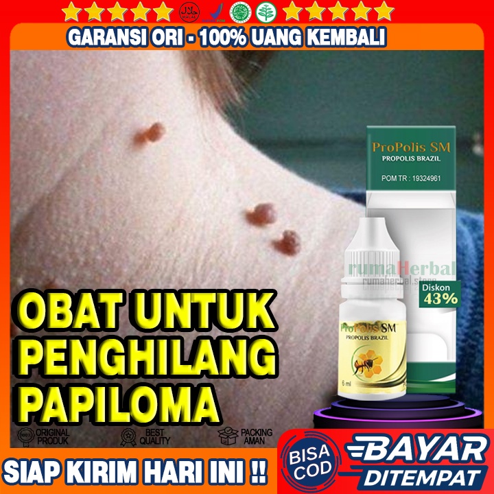 Obat Penghilang Papiloma, Papiloma di Leher dan Wajah, Penghilang Kutil, Perontok Kutil di Leher
