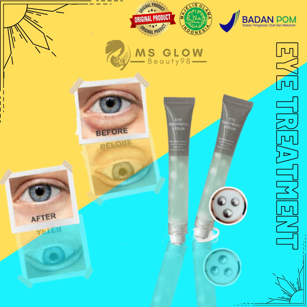 Eye Treatment Serum Ms Glow/Ms Glow Eye Treatment Serum