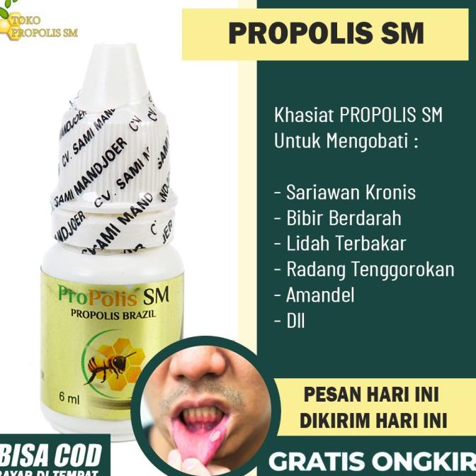 [[ Eferiusaya ]] Obat Sariawan Akut - Sariawan Parah - Sariawan Berdarah - Propolis SM