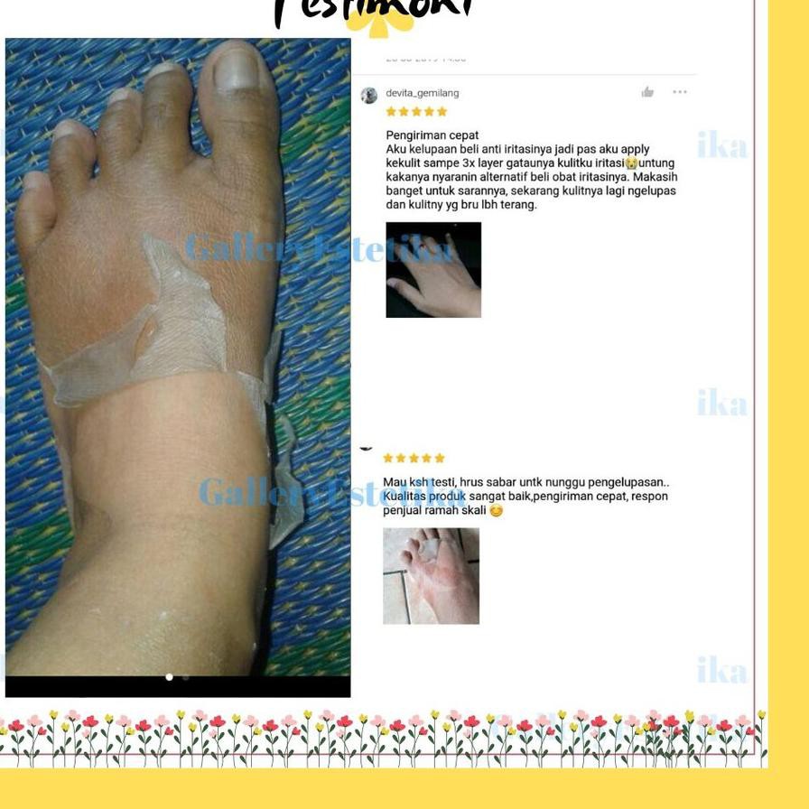 qт LA062 qω home Peel GEL T15% pengelupas pengangkat kulit mati/ kusam/ flek wajah badan яqяяяя