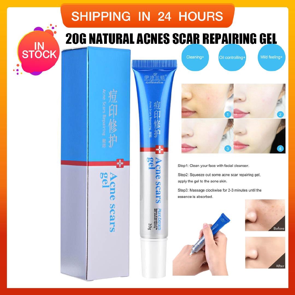 ointment for pimples and scars