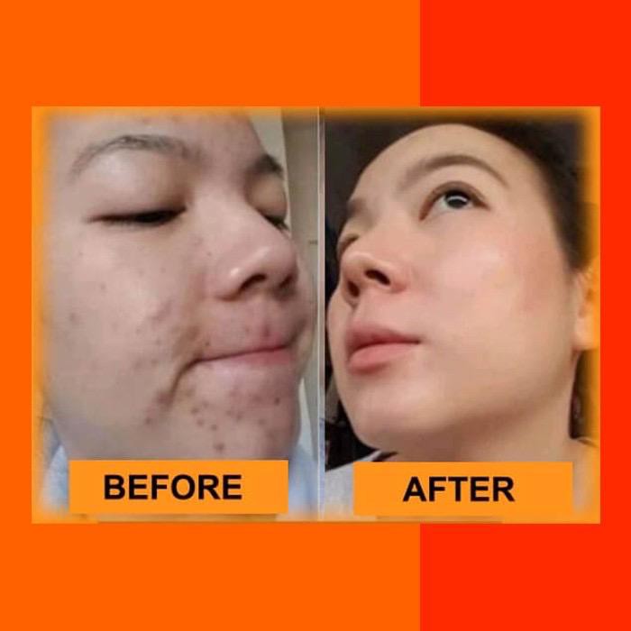 promo [ BISA COD ] Espio Terlaris Sabun Collagen Memutihkan Kulit Wajah &amp; Seluruh Badan