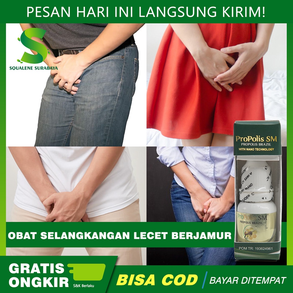 Obat Selangkangan Lecet Berjamur - Kurap Selangkangan - Gatal Gatal Bau Tidak Sedap - Selangkangan B