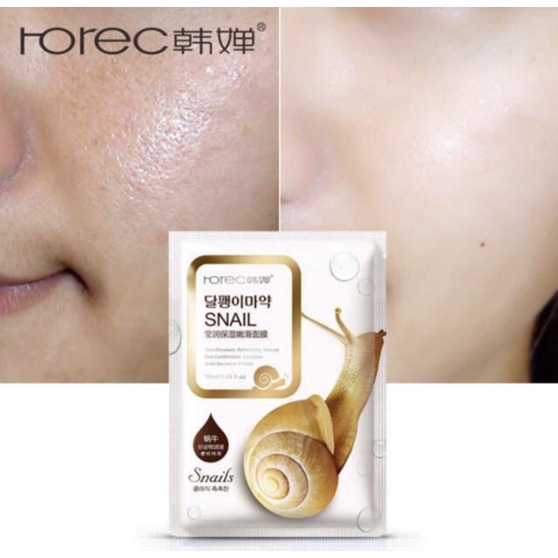 ROREC SNAIL SHEET MASK / MASKER WAJAH / ROREC MASK / ROREC SNAIL