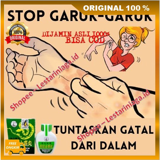 [BISA COD] Ramuan Cina Snake Itch Biduran Eksim Ampuh 100% ORIGINAL
