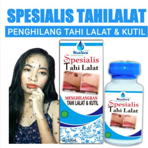 Spesialis Tahi Lalat Penghilang Tahi Lalat & Kutil / Spesialis Tahilalat / Obat Tahi Lalat / Kutilos