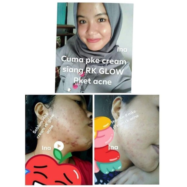 RK Glow Acne Pt.Affor Neo Jaya