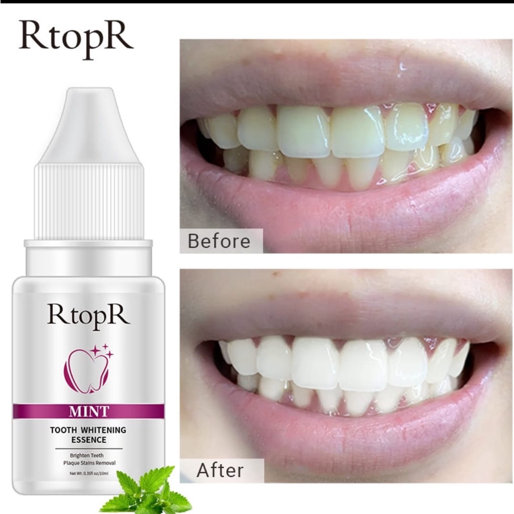 RtopR TOOTH WHITENING ESSENCE / PEMUTIH GIGI