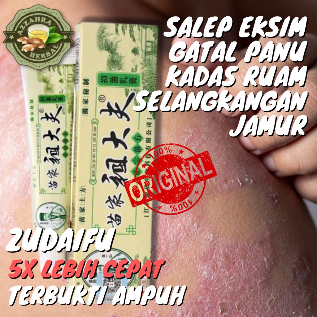 Salep Gatal Jamur Panu Kadas Ruam Eksim Selangkangan / Salep KL / Salep HL / Salep Pi Kang Wang / ZUDAIFU - Salep Sakit Kulit Eksim / Penyakit Kulit Panu Kadas Kurap