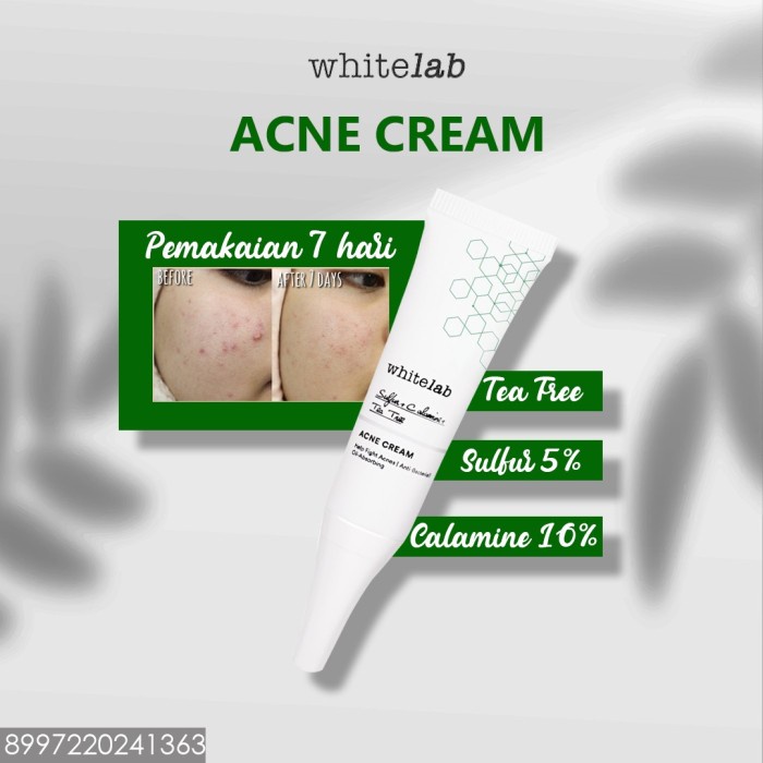 Whitelab WL Acne Cream tidak ada jerawat lagi