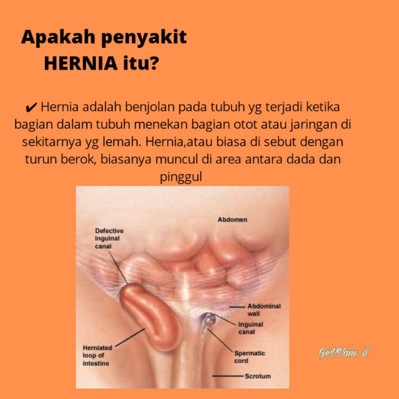 Celana Hernia Cowo Laki laki  Anak Dewasa Murah Berkualitas