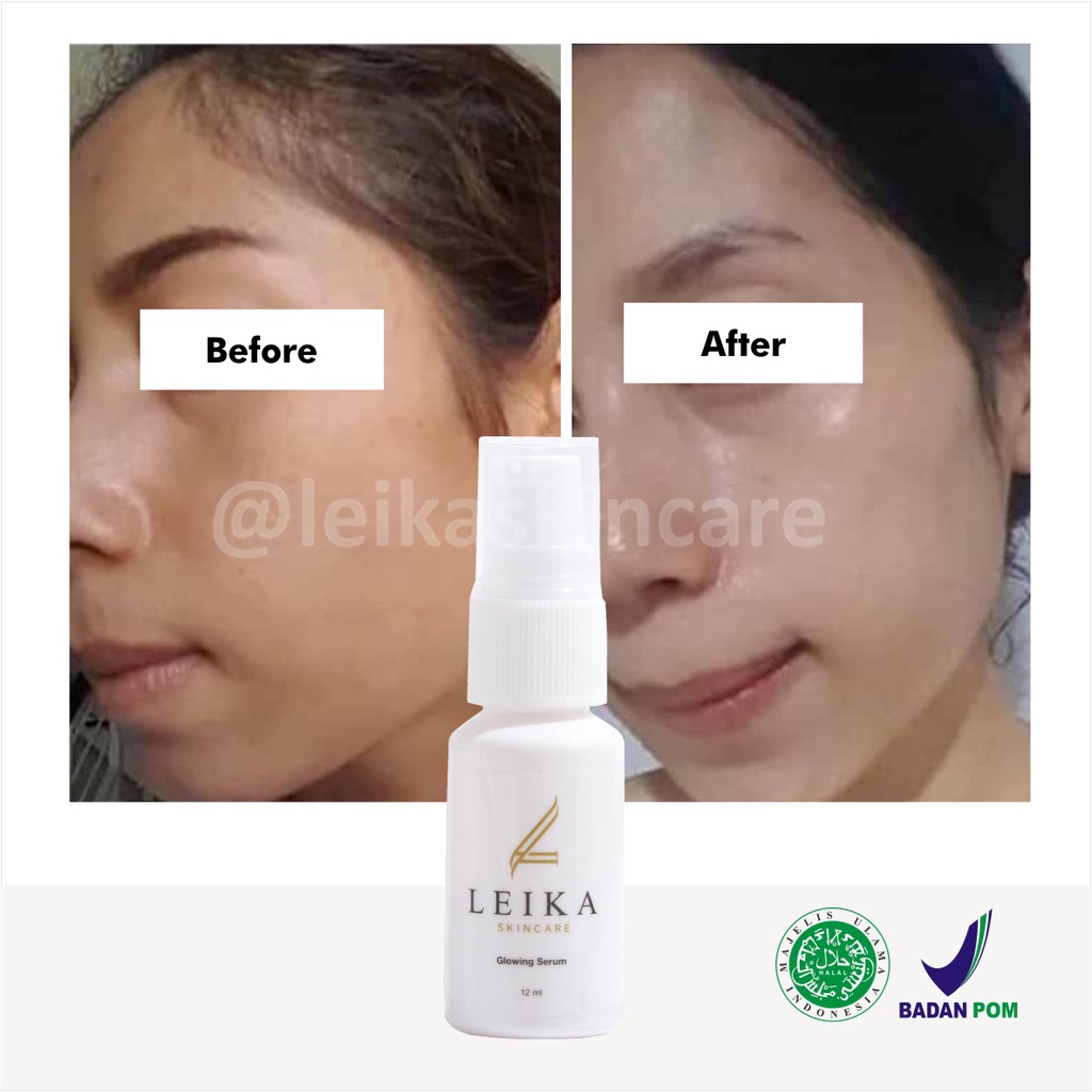 Ampuh! Pelembab Wajah untuk Kulit Wajah Kering dan Kusam Ampun BPOM Pelembab untuk Wajah Buat Kulit Normal Sensitif Glowing Serum Leika Skincare 12ml Asli HALAL MUI Resmi BPOM