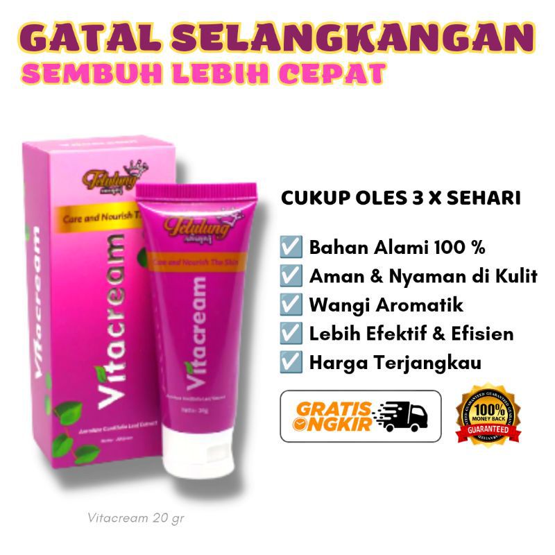 Vitacream Salep gatal ruam kulit di selangkangan ampuh - Obat ruam kulit sekitar kelamin paling ampu