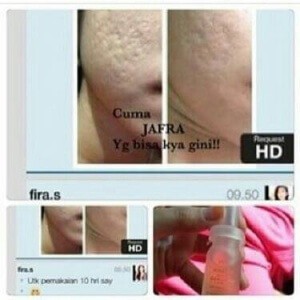 ROYAL JELLY LIFT CONCENTRATE SERUM ORI ORIGINAL JAFRA