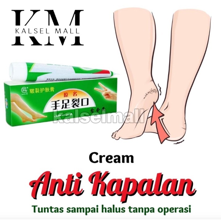 Cream Salep Obat Krim Original 100% AMAN AMPUH Salap Tumit Kaki Tangan Pecah Pecah Tumit Ampuh Kering Kulit Tebal Mengelupas Bekas Luka Kapalan Mengelupas  Kapalan Kering Tebal Rayapan Kasar OC3