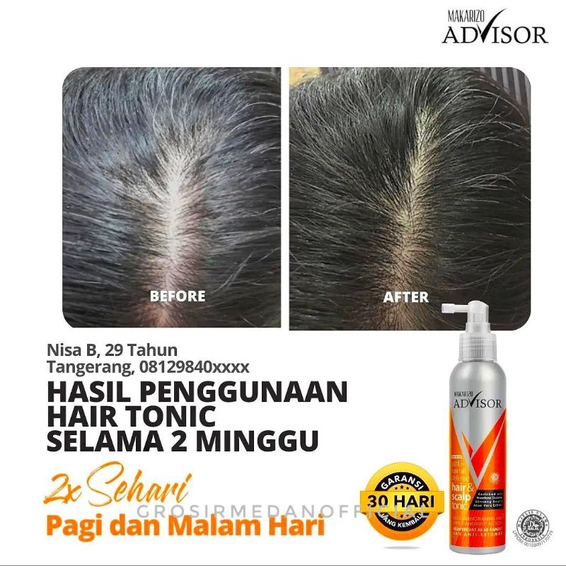 MAKARIZO ANTI HAIR FALL DEFENSE - TONIK ANTI RAMBUT RONTOK DAN KETOMBE - MAKARIZO ADVISOR HAIR AND SCALP TONIC