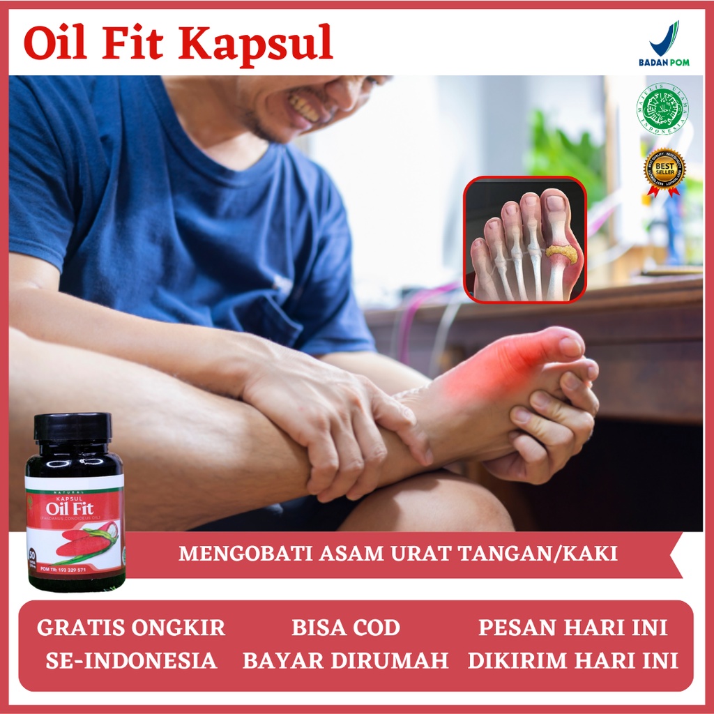 Obat Asam Urat, Obat Asam Urat di Kaki, Obat Asam Urat dan Rematik, Obat Asam Urat dan Kolesterol, O