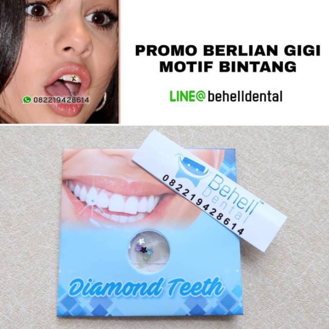 Permata Gigi . Berlian . Diamond gigi motif tetes love bintang