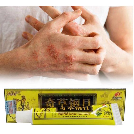 OBAT GATAL EKSIM KERING MENAHUN AMPUH SALEP EKSIM GATAL GATAL KULIT PANU KURAP